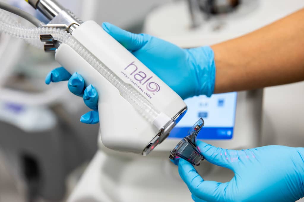 HALO laser handpiece held by a provider